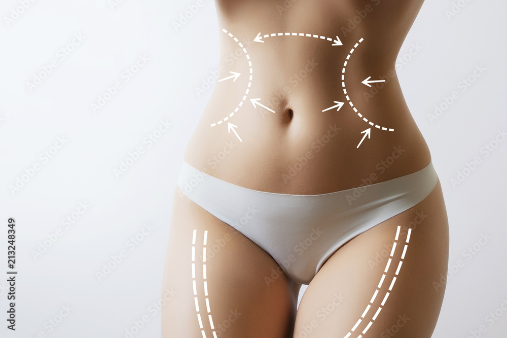 slim woman body with marks on stomach - obrazy, fototapety, plakaty 