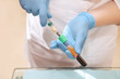 Blood plasma out of the vial into the syringe