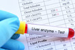 Abnormal high liver enzyme test result with blood sample tube