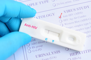 Wall Mural - HIV negative test result by using rapid test cassette