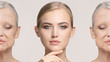 © master1305 - Comparison. Portrait of beautiful woman with problem and clean skin, aging and youth concept, beauty treatment
