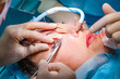 © Georgii - Plastic surgery in operating room