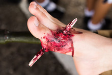Fake Wound.on Foot, Wound Makeup Special Effect, Selective Focus, Abstract Blur Background, Shallow Depth Of Field