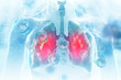 Virus and bacteria infected the Human lungs. lung disease