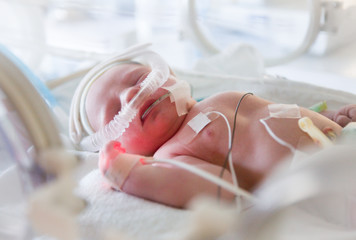 premature newborn baby in incubator