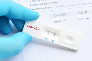 Wall Mural - HIV positive test result by using rapid test cassette