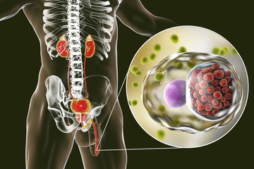 Poster - Chlamydiosis infection in man, 3D illustration showing close-up view of Chlamydia trachomatis bacteria infecting urethral epithelial cells, found as chlamydial intracytoplasmic inclusions in a cell