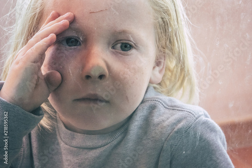 Little Children Blonde Hair With Cut On His Front Looking Inside