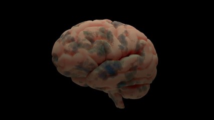 Poster - 3d render of brain with damage zones. Infection or another reason of brain damage concept. Animation of growing brain damage zone. Isolated.