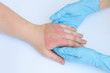 Doctor's hands holding female hand with second degree burns on white background. Doctor examining of the patient. Patient cheering and support