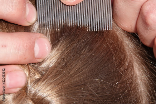 Checking A Young Girls Hair For Head Lice Buy This Stock Photo