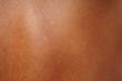 Leinwandbild Motiv close-up human skin damged by age and sun tanning