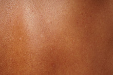 Close-up Human Skin Damged By Age And Sun Tanning