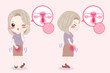 © Lin - woman with menopause problem