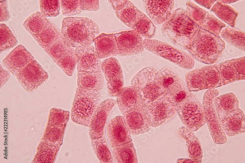 Photographie Root tip of Onion and Mitosis cell in the Root tip of Onion with dye extracts in glutinous rice under a microscope