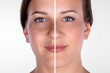 © Andrey Popov - Woman's Face Before And After Cosmetic Procedure