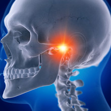3d Rendered Medically Accurate Illustration Of A Painful Temporomandibular Joint