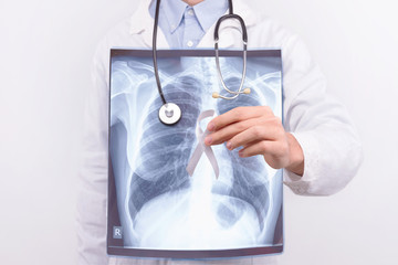 Oncological lung cancer disease concept. Guy male man holding medical lung body x-ray photo with pinned white ribbon as a symbol of lung cancer on white isolated background