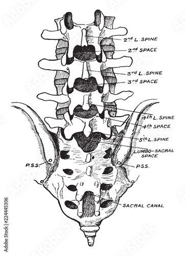 Fotografía Lumbar Showing Position of Fourth Lumbar Spine, vintage illustration