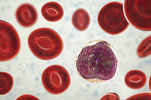 Lymphoblast, An Immature White Blood Cell