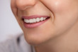 © Cherries - Healthy teeth of a smiled woman