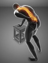Man With Back Pain, Illustration