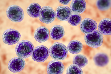 Poster - Burkitt's lymphoma cells, a cancer of the lymphatic system, monoclonal B-cell tumor, 3D illustration