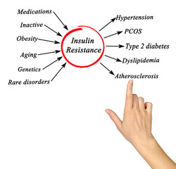 Canvas Print - Causes and effects of Insulin Resistance