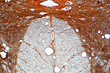 Cross section of spinal cord under the microscope view.