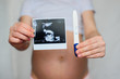 © alexkoral - ultrasound picture and positive pregnancy test in the hands of a pregnant girl on the background of the abdomen
