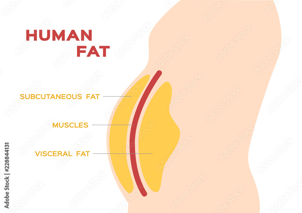 human belly and abdomen fat layer vector / subcutaneous and visceral ...