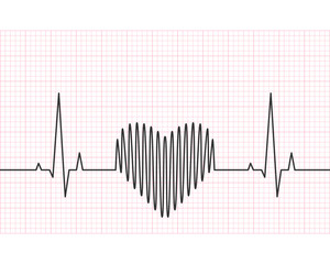 Wall Mural - Heart rate line with grid in the background. Heartbeat, pulse and rythm, electrocardiogram and ECG concept. Vector illustration.