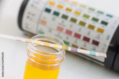 Fotografía Strip of pH paper resting on specimen, with comparison chart box