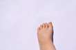 The usual flat wart on the child's toe.