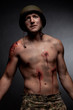 a military soldier struggles show his scars on his face and body