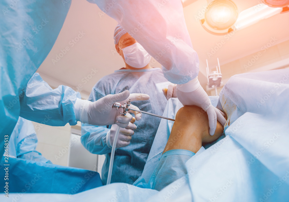Arthroscope surgery. Orthopedic surgeons in teamwork in the operating room with modern arthroscopic tools. Knee surgery. - obrazy, fototapety, plakaty 
