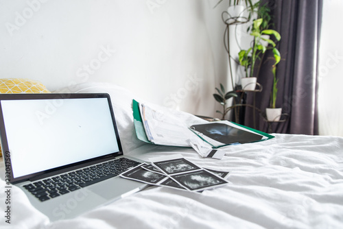 Fotografía x-ray ultrasonography laptop with white screen on the bed