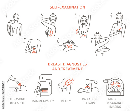 Cuadros en Lienzo Breast cancer, medical infographic