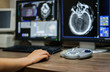 © pangoasis - Radiotechnologist hand holding mouse while working on CT scan workstation, CT brain image is background