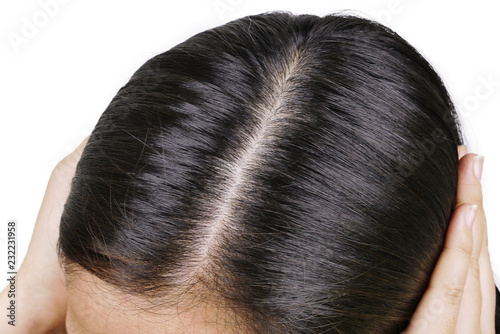 Adult Girl With Hair Loss Problem Receiving Injection Treatment
