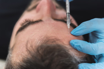 Man having forehead fillers done