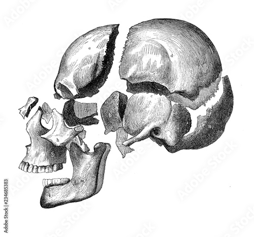 Fotografía Vintage illustration of anatomy, skull with jaw and teeth, bone decomposition vi