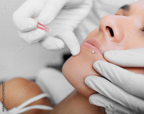 Fotografía cropped woman face getting facelift , procedure mesothreads lifting skin