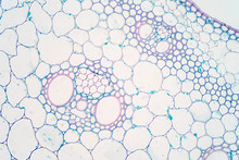 Cross Sections Of Plant Stem Under Microscope View.