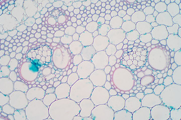 Wall Mural - Cross sections of plant stem under microscope view.