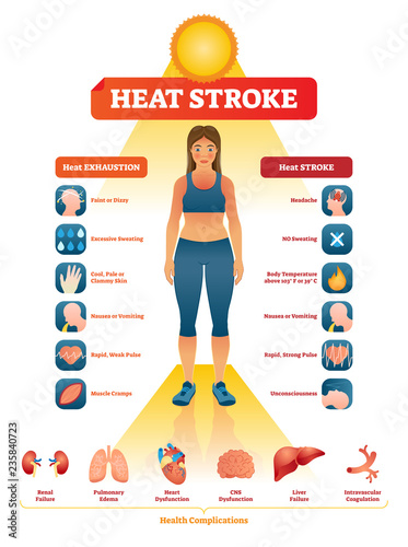 Fotografía Heat stroke vector illustration