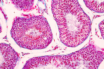 Poster - Cross section of Testis tissue under the microscope for education.