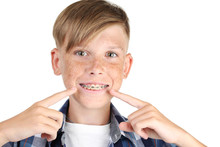 Young Boy With Dental Braces On White Background
