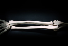 Radius And Ulna Human Bone Close Up Isolated On Black Background