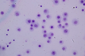 Poster - Chromosomes Human under the microscope for education.